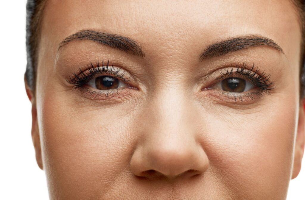 A close-up of a woman's eyes after receiving dry eye treatment.